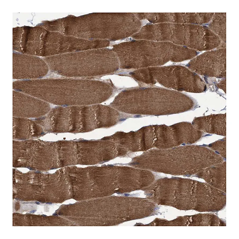 Atlas Antibodies Anti-NAA15 Antibody