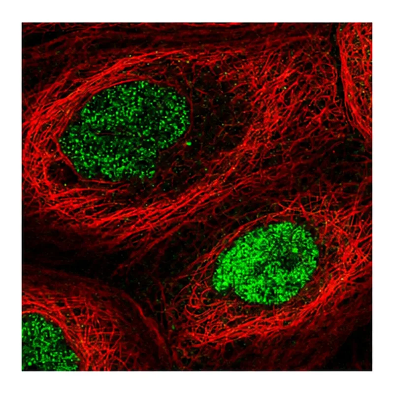 Atlas Antibodies Anti-N6AMT1 Antibody
