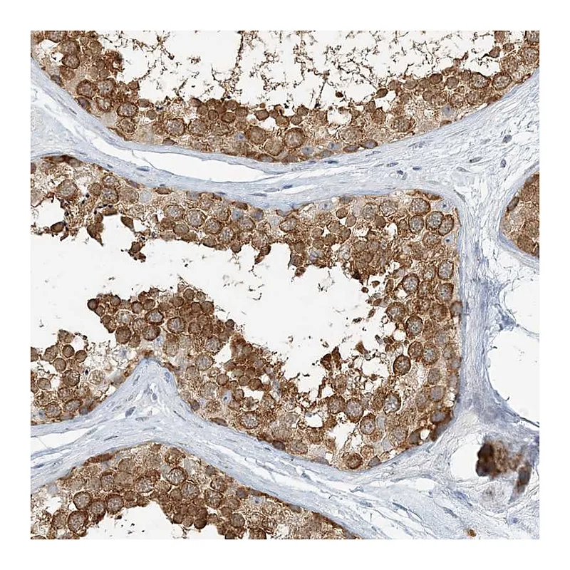 Atlas Antibodies Anti-NAA11 Antibody