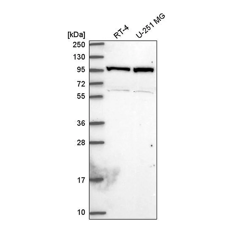 Atlas Antibodies Anti-NAA15 Antibody