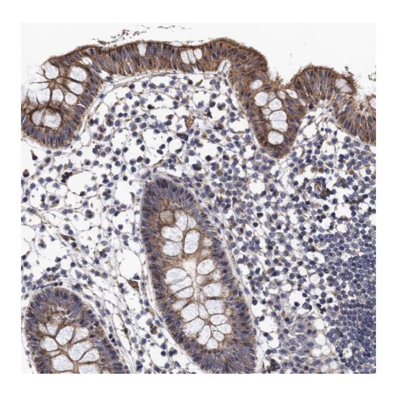 Atlas Antibodies Anti-NAA16 Antibody