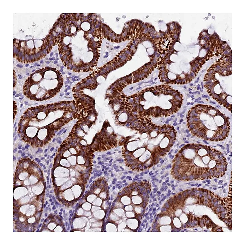 Atlas Antibodies Anti-NAA16 Antibody