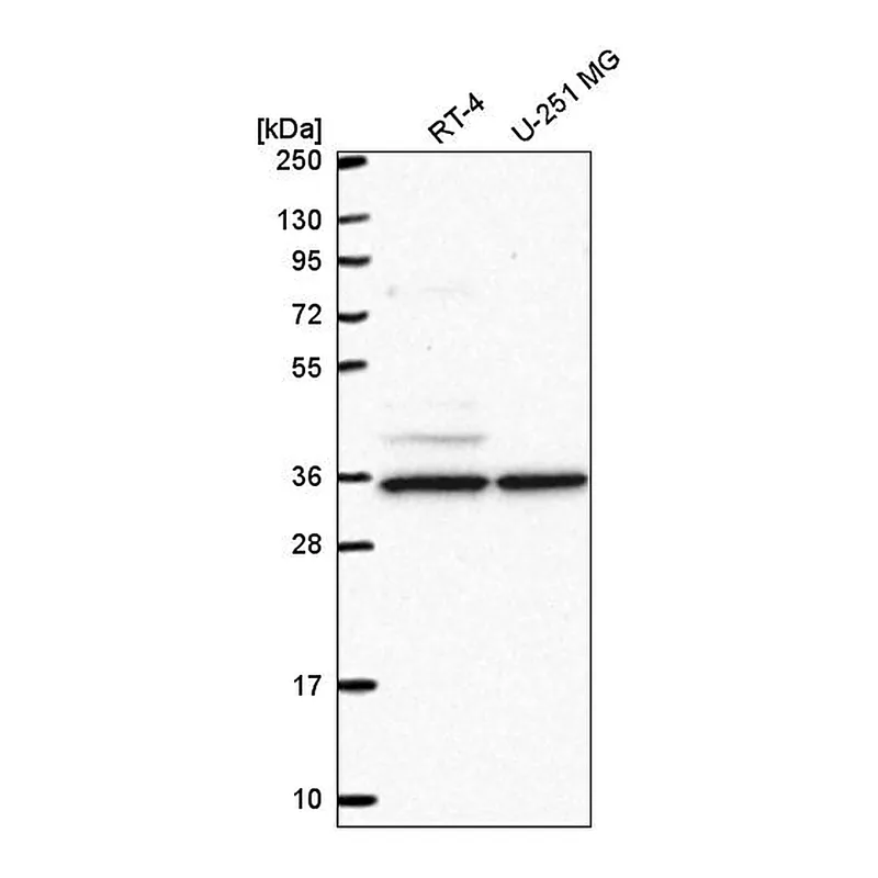 Atlas Antibodies Anti-NAA35 Antibody
