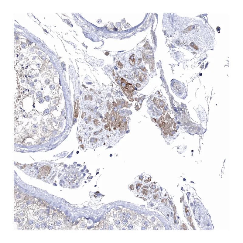 Atlas Antibodies Anti-NAA40 Antibody