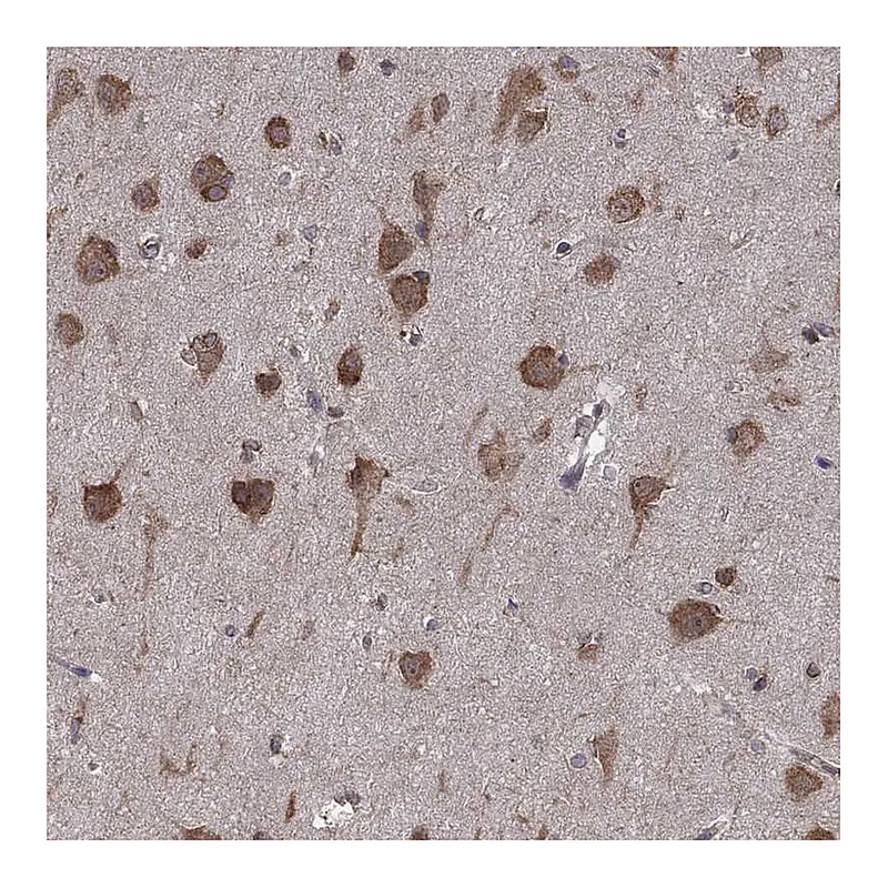 Atlas Antibodies Anti-NAA50 Antibody