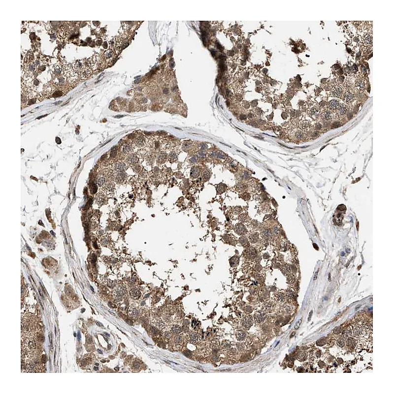 Atlas Antibodies Anti-NAA35 Antibody