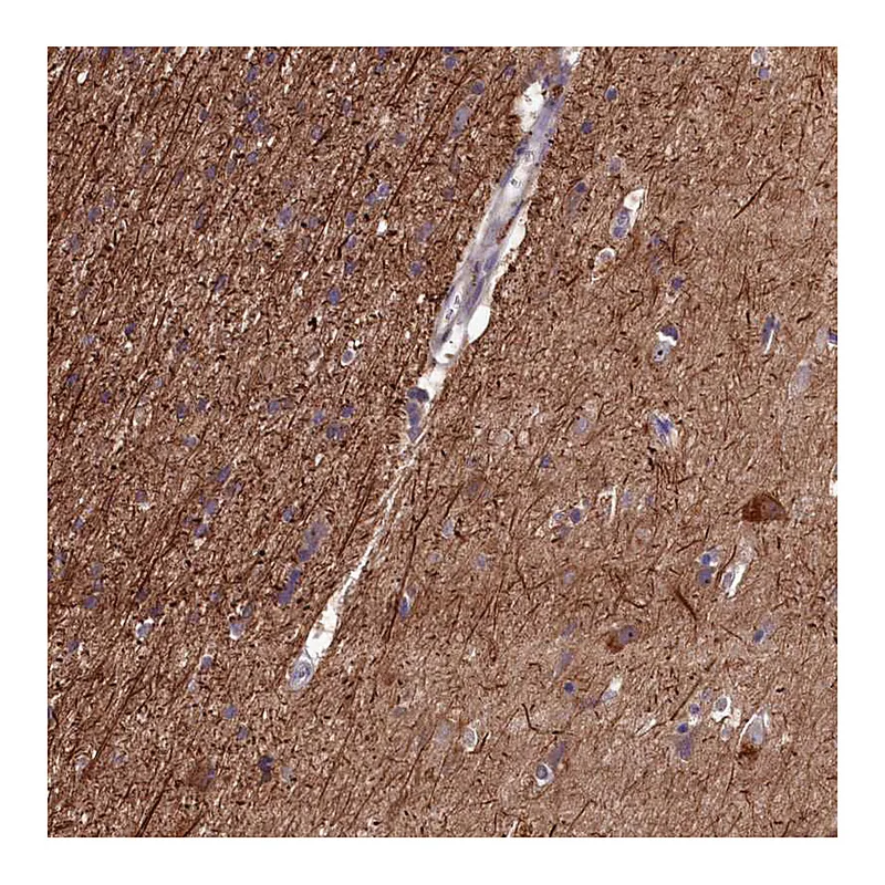 Atlas Antibodies Anti-NAA60 Antibody