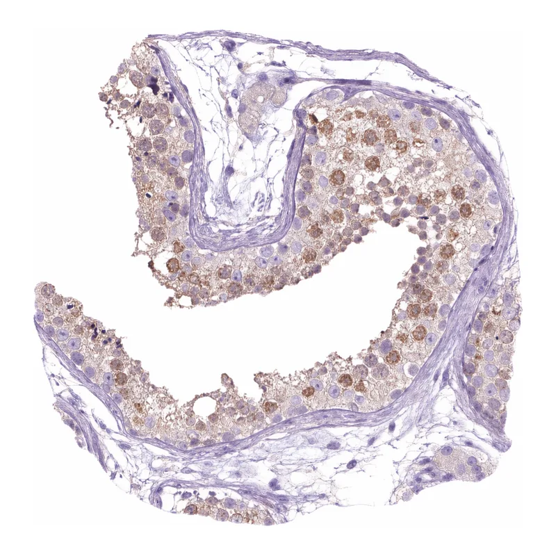 Atlas Antibodies Anti-NAALAD2 Antibody