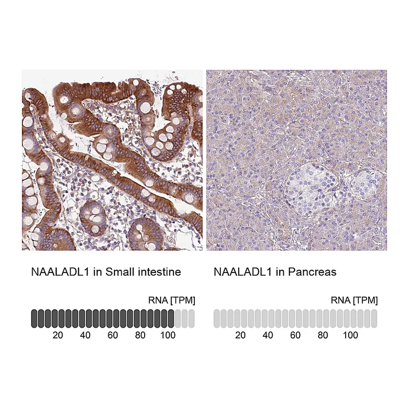 Atlas Antibodies Anti-NAALADL1 Antibody