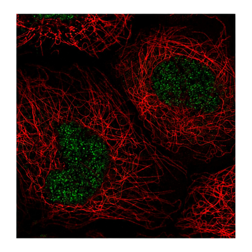 Atlas Antibodies Anti-NABP1 Antibody