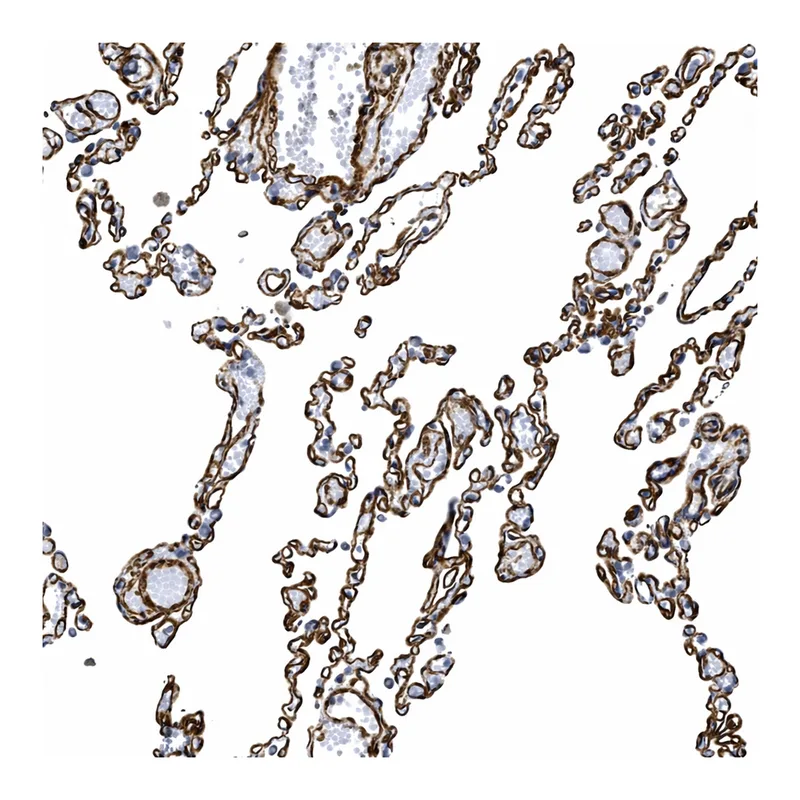 Atlas Antibodies Anti-NAB1 Antibody