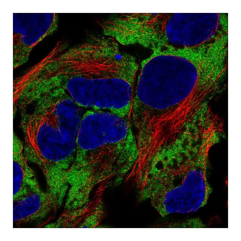 Atlas Antibodies Anti-NACA Antibody