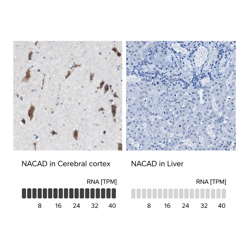 Atlas Antibodies Anti-NACAD Antibody