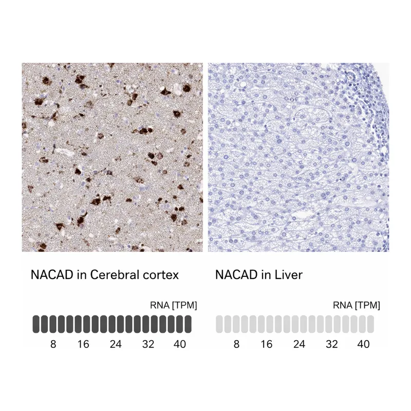 Atlas Antibodies Anti-NACAD Antibody