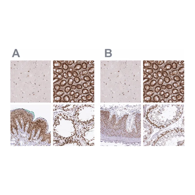 Atlas Antibodies Anti-NACC1 Antibody