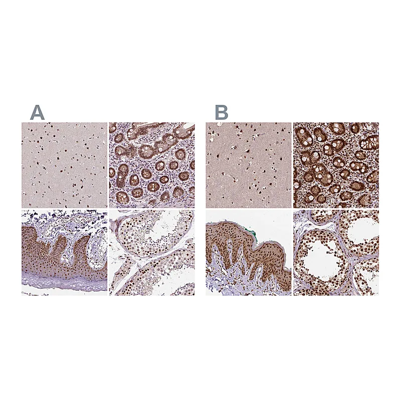 Atlas Antibodies Anti-NACC1 Antibody