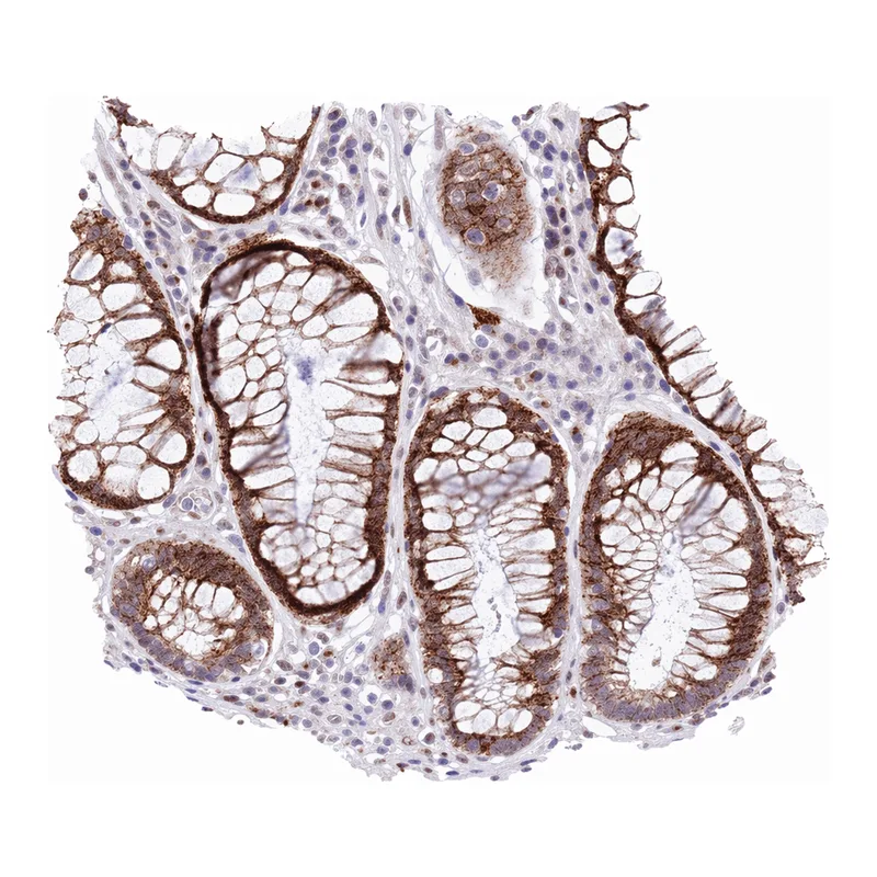 Atlas Antibodies Anti-NACC2 Antibody