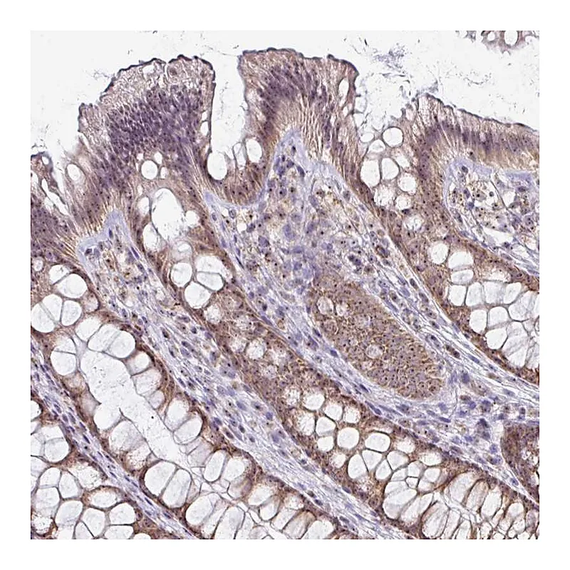 Atlas Antibodies Anti-NACC2 Antibody