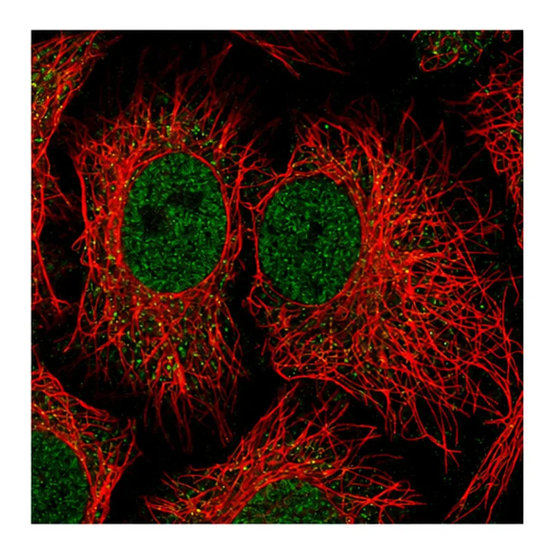 Atlas Antibodies Anti-NADK Antibody