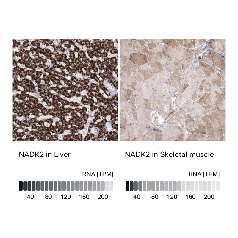 Atlas Antibodies Anti-NADK2 Antibody