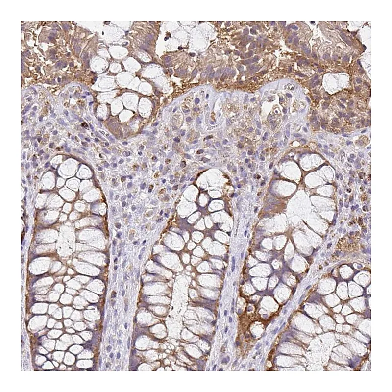 Atlas Antibodies Anti-NADSYN1 Antibody
