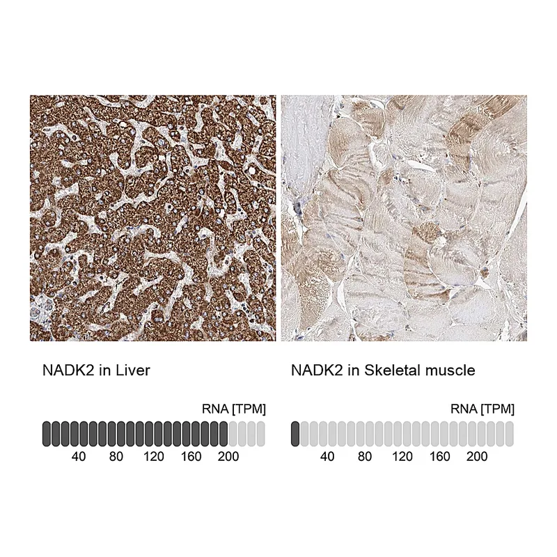 Atlas Antibodies Anti-NADK2 Antibody