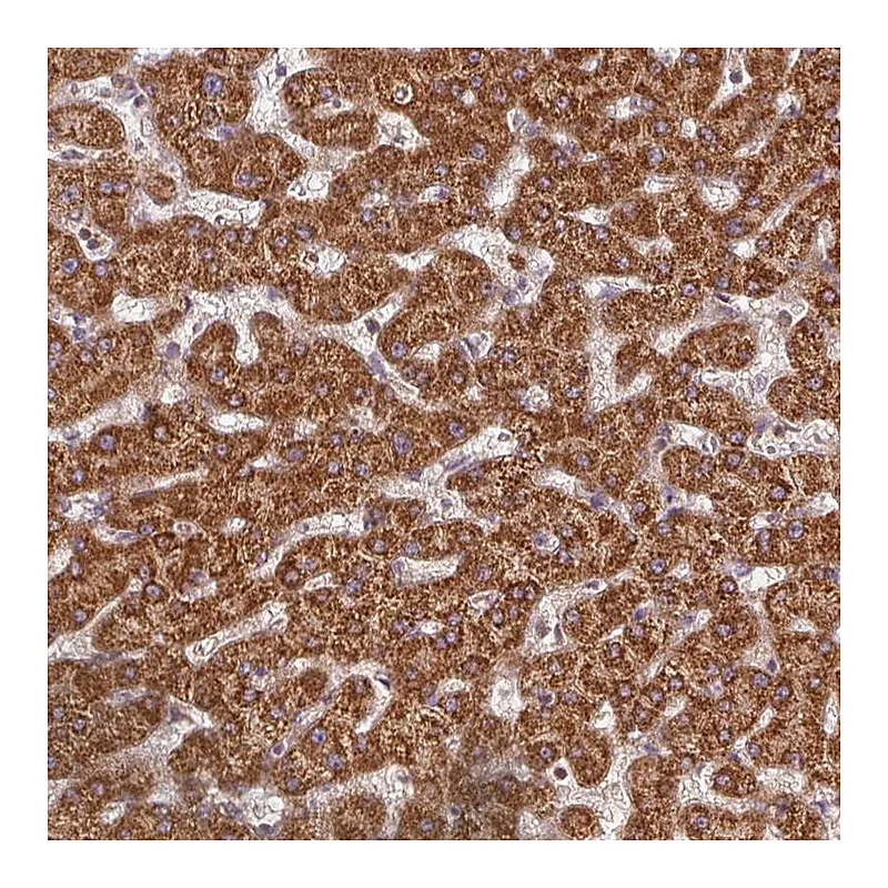 Atlas Antibodies Anti-NADK2 Antibody