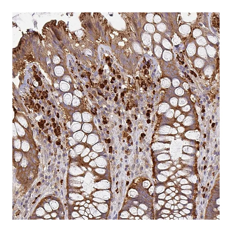 Atlas Antibodies Anti-NADSYN1 Antibody