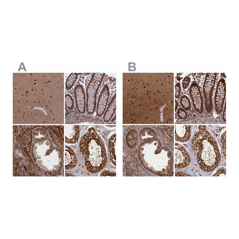 Atlas Antibodies Anti-NAE1 Antibody