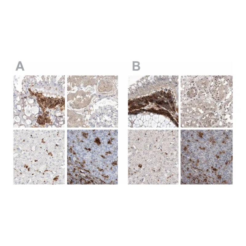 Atlas Antibodies Anti-NAGK Antibody