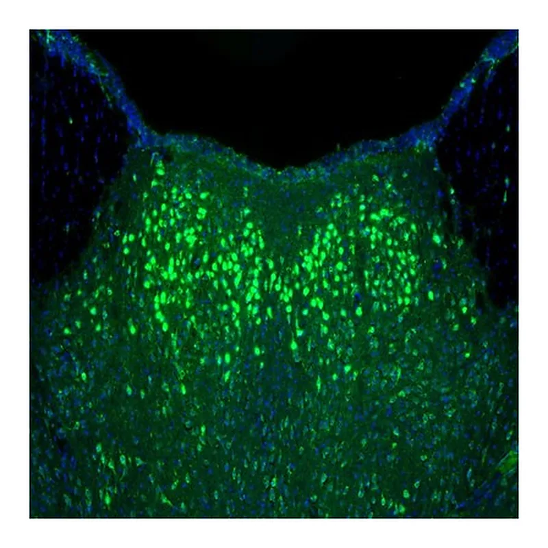 Atlas Antibodies Anti-NAGLU Antibody