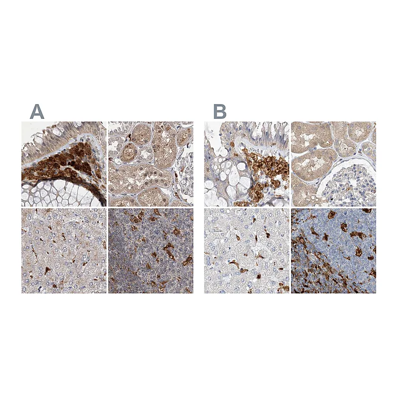Atlas Antibodies Anti-NAGK Antibody