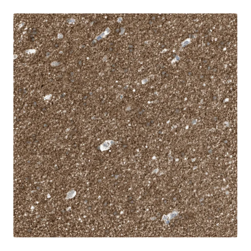 Atlas Antibodies Anti-NALCN Antibody