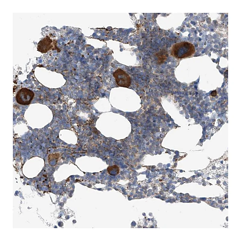 Atlas Antibodies Anti-NALCN Antibody