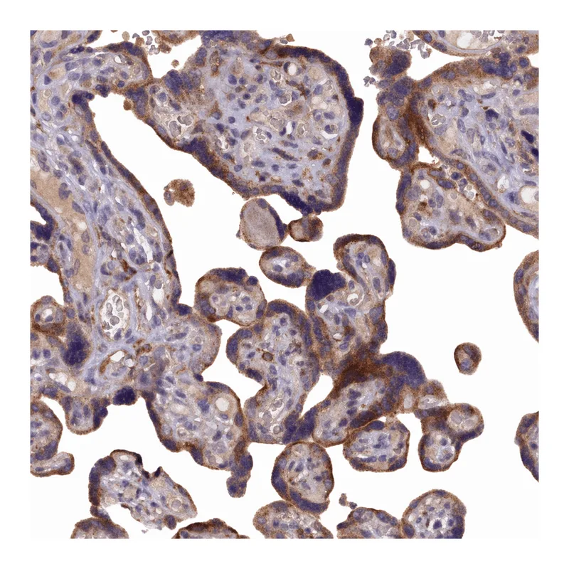 Atlas Antibodies Anti-NAIP Antibody