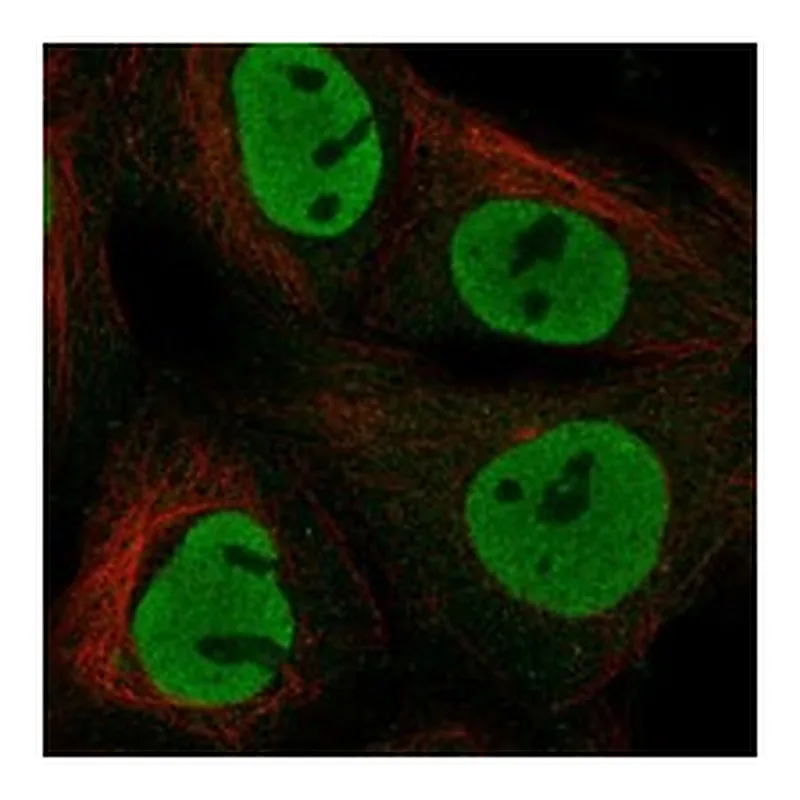 Atlas Antibodies Anti-NANOG Antibody