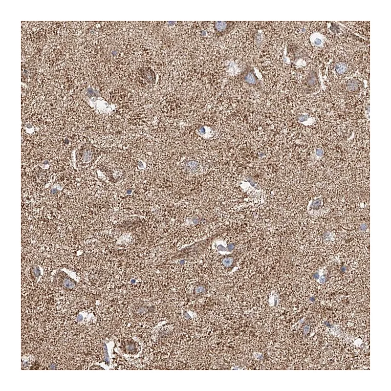 Atlas Antibodies Anti-NALCN Antibody