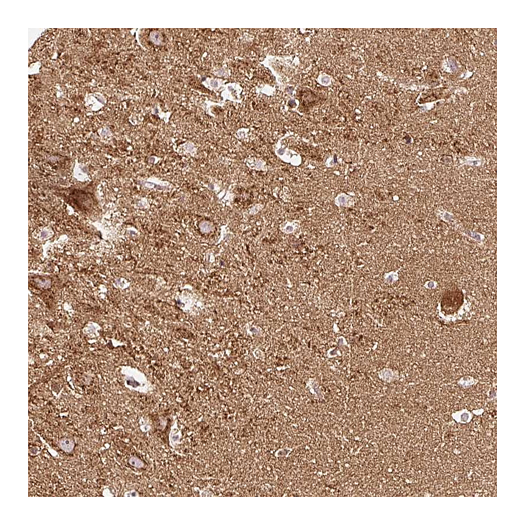 Atlas Antibodies Anti-NAPA Antibody