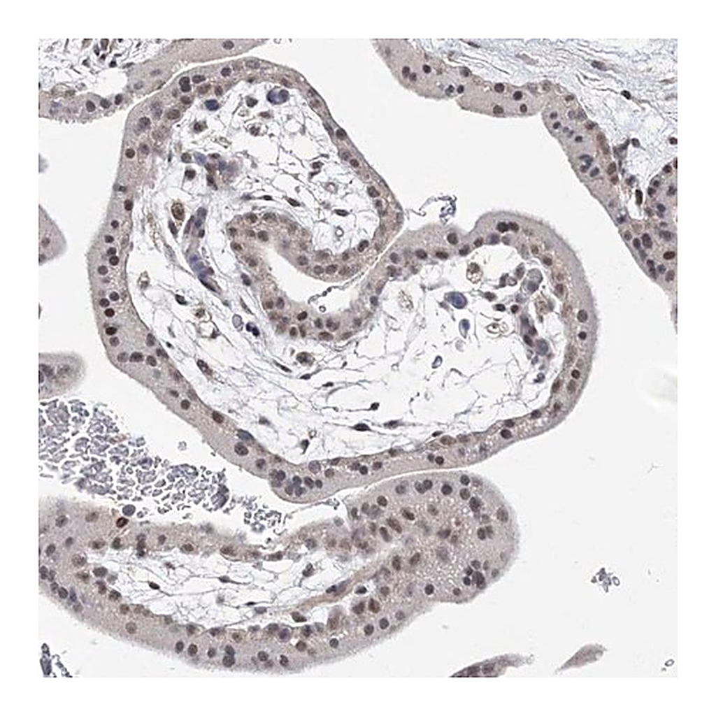 Merck Anti-BOD1L1 antibody produced in rabbit