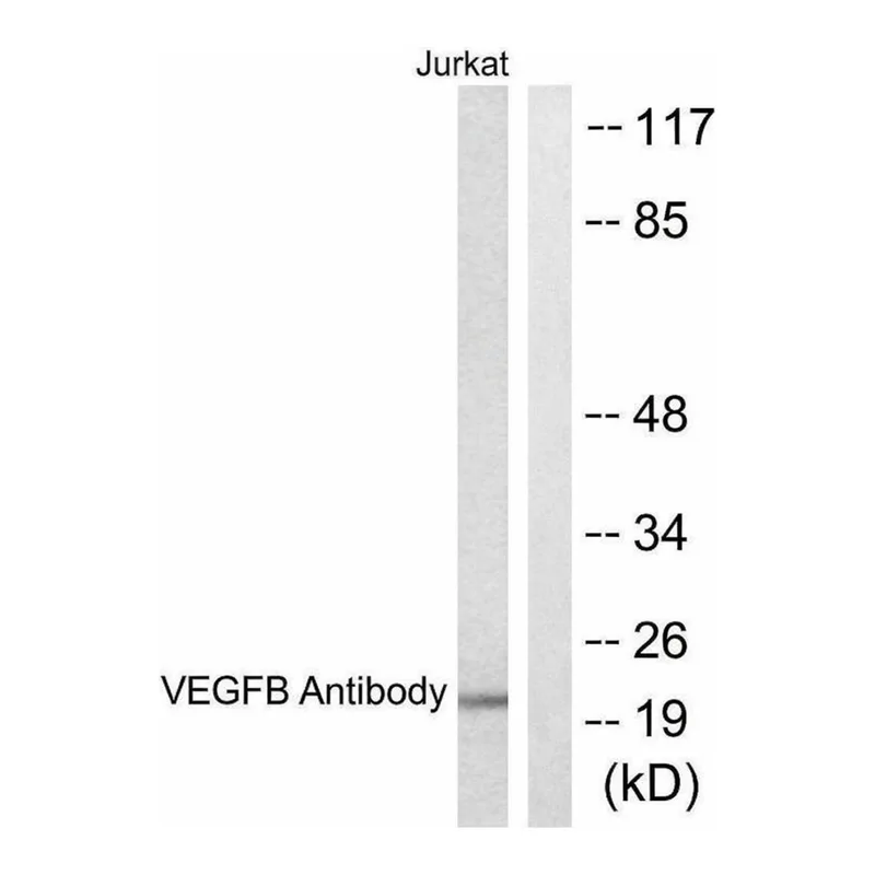 Merck Anti-VEGFB antibody produced in rabbit