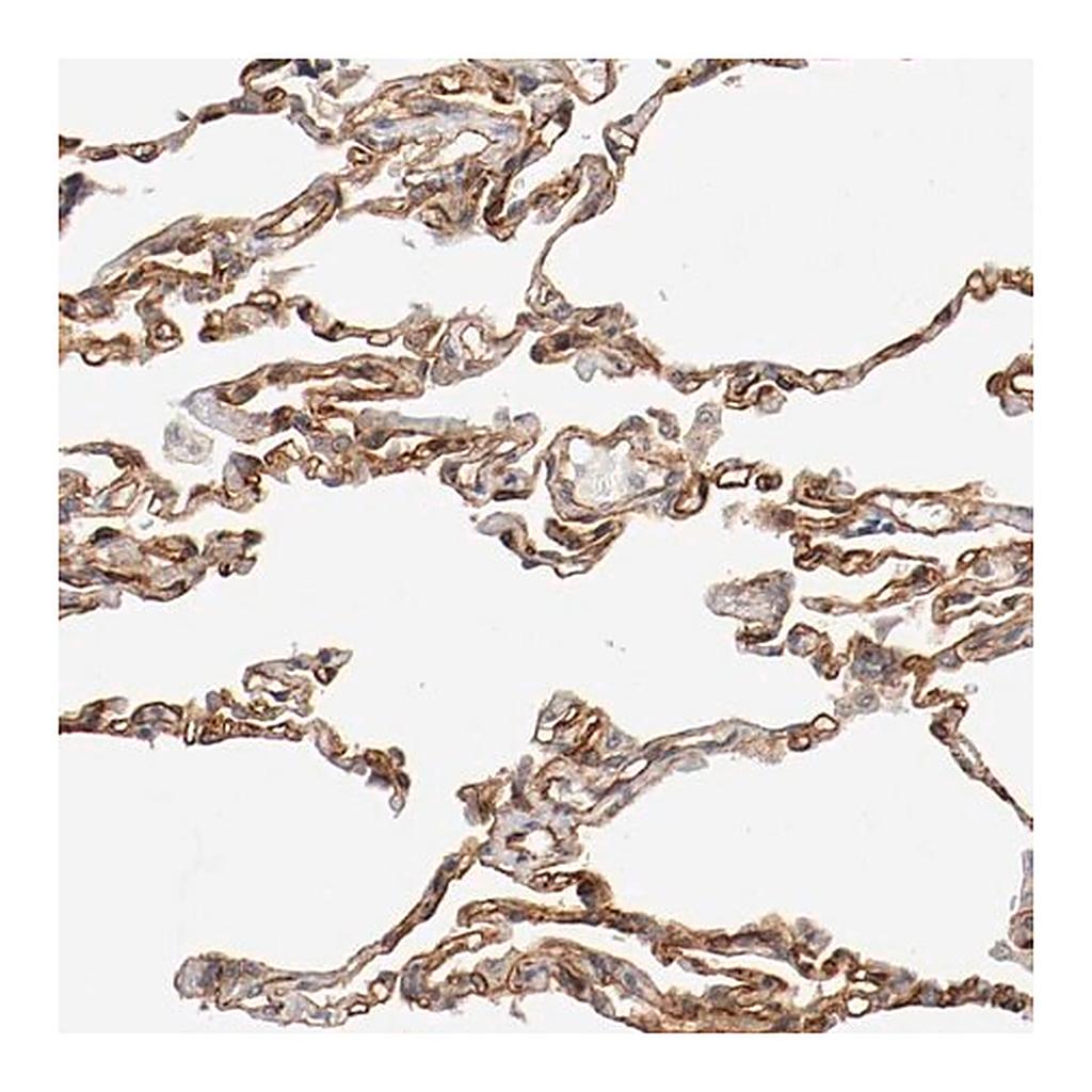 Merck Anti-TYK2 antibody produced in rabbit