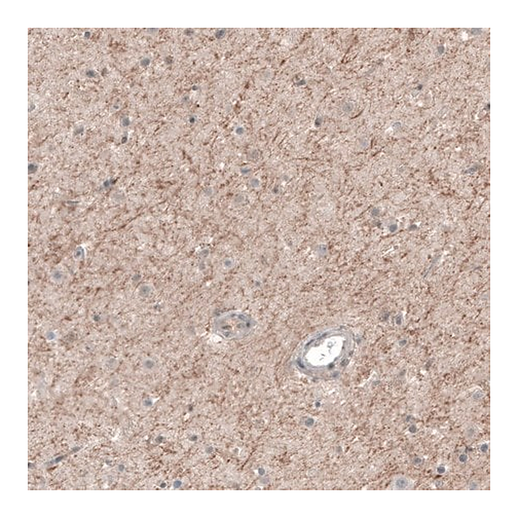Merck Anti-CHRM3 antibody produced in rabbit