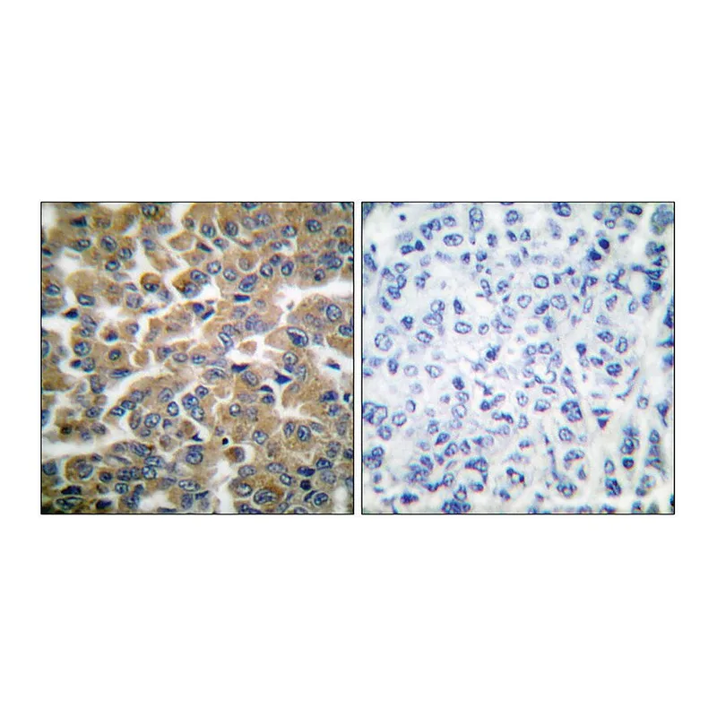Merck Anti-GR antibody produced in rabbit