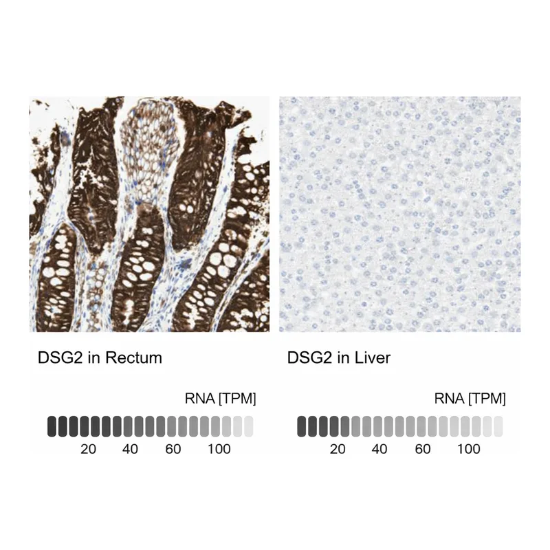 Merck ANTI-DSG2