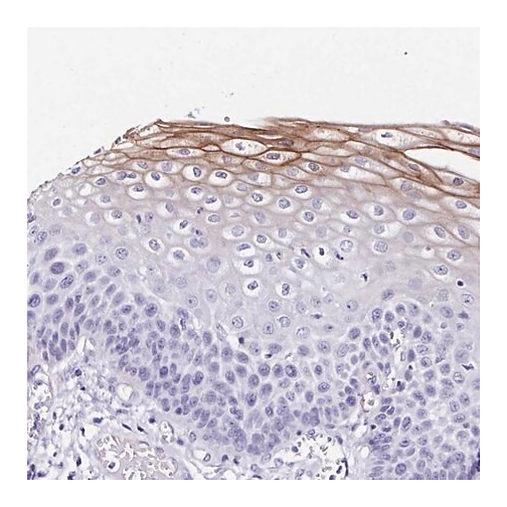 Merck Anti-TMPRSS11E antibody produced in rabbit