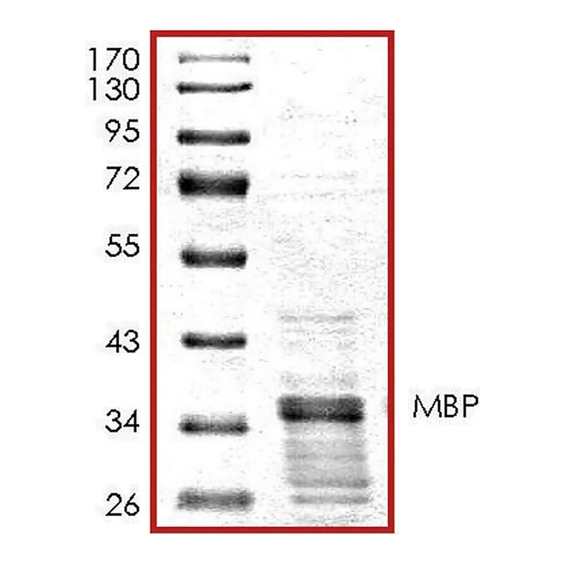 Merck MBP, GST tagged human