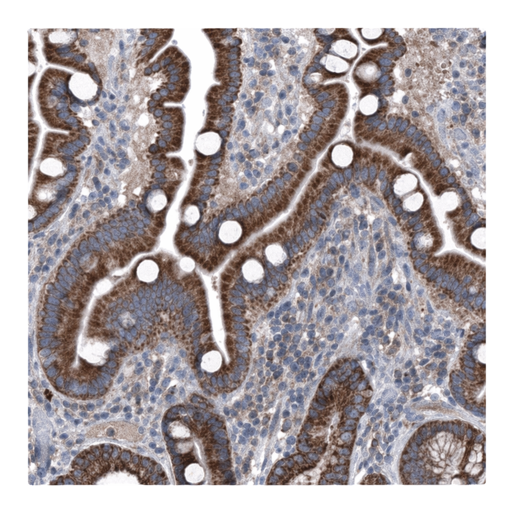 Merck Anti-GPAT3 antibody produced in rabbit