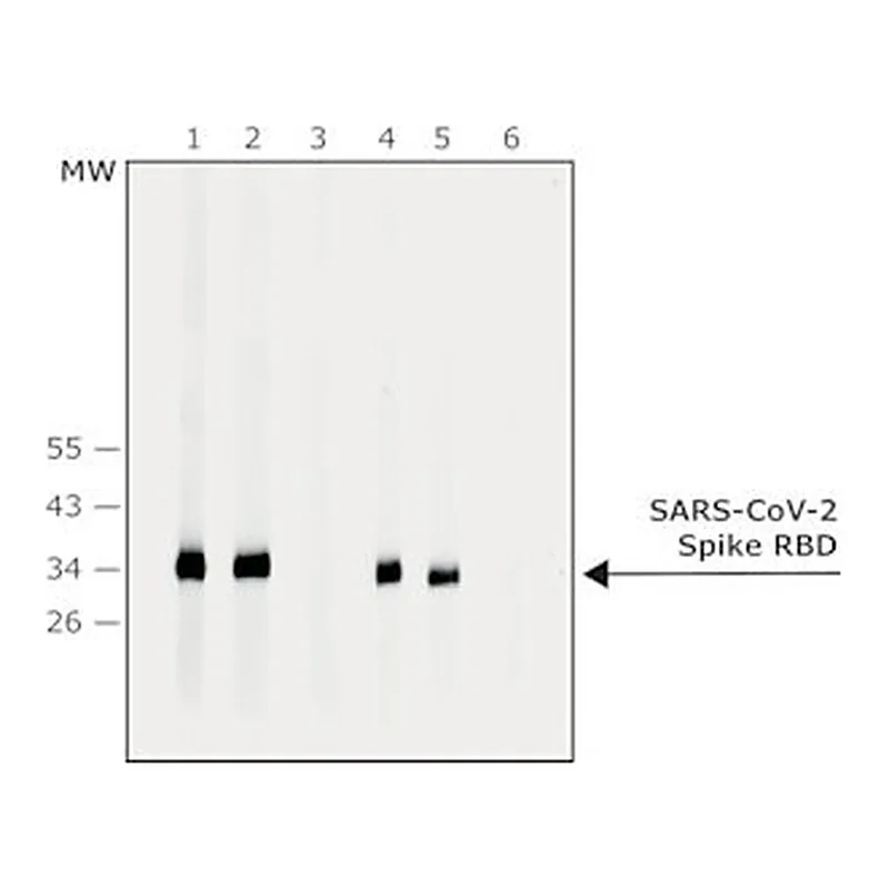 Merck Anti-SARS-CoV-2-Spike protein