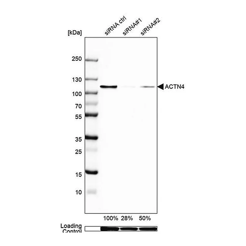 Merck Anti-ACTN4 antibody produced in rabbit