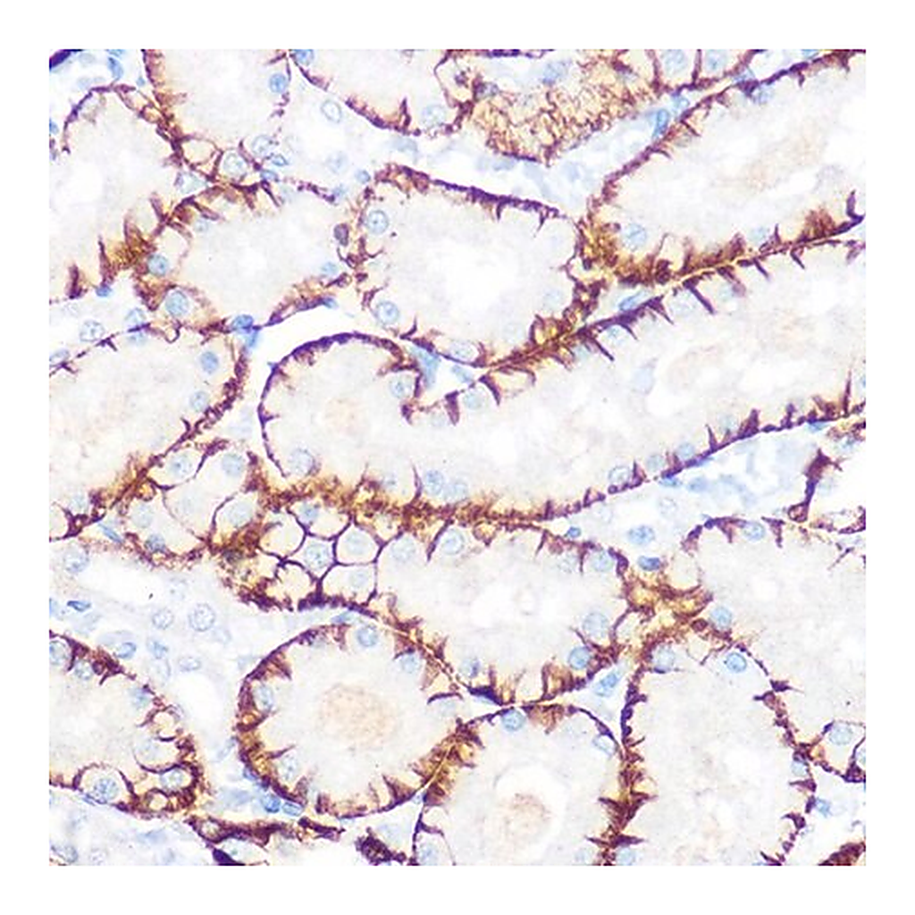 Merck Anti-NDRG1 antibody produced in rabbit